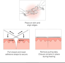 Load image into Gallery viewer, ITEM# 0210   Emergency Laceration Kit - Repair Wounds Without Stitches. FDA Cleared Skin Closure Device for a Wound Up to 1 1/2 Inches in Length. Complete Kit to Clean, Close, and Cover Wounds. (Watch Video)
